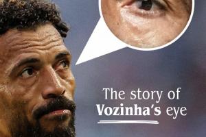 眼科医生：沃齐尼亚左眼患有翼状胬肉，可能因长期暴露在太阳下